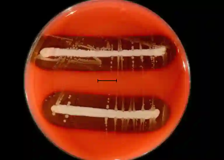 cultivo de bacterias, coriza infecciosa aviar
