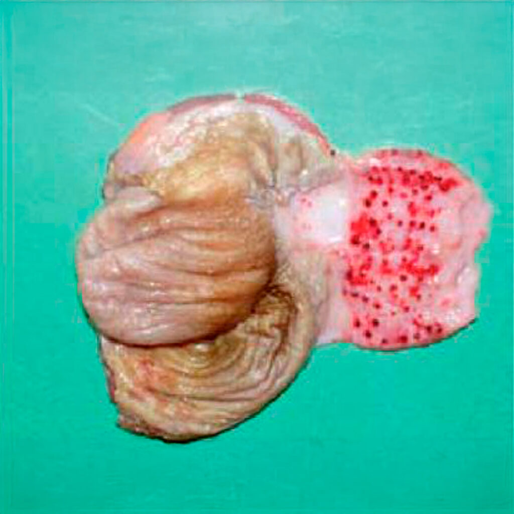 Órgano de ave infectado con Newcastle